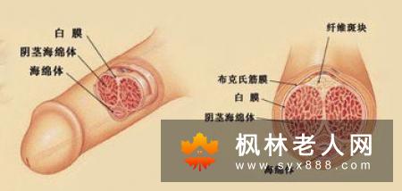 男性无法幸免尿道炎 预防有妙招