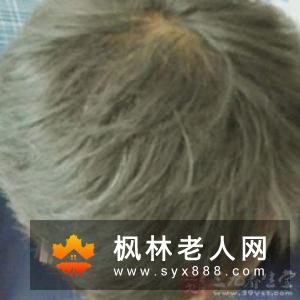 男人养肺的方法:笑一笑中医有常笑宣肺一说养生频道!