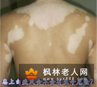 男人患上梅毒有哪些症状?一期梅毒患者梅毒的影响主要有2个!