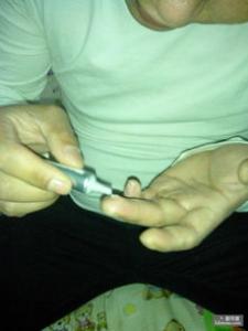 男性健康从细节观察 为何小便有乳白色液体