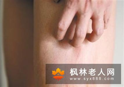男性如何自诊龟头炎 龟头炎的种类有哪些