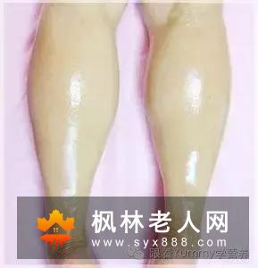 女性水肿怎么办  补充含钾食物可以消肿