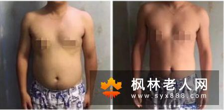男人养生排毒吃什么好?男人为什么也需要排毒,绿豆汤有通行十二经络、解毒