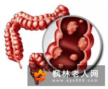 癔病性痉挛产生的原因