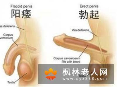 男人阳痿都有什么症状?北京男科医院专家为您解答,专家提醒您高度关注!