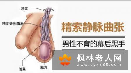 男性患精索静脉曲张的主要危害有哪些