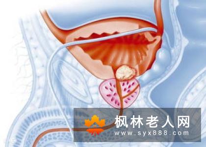 夜尿多是膀胱炎引起的吗