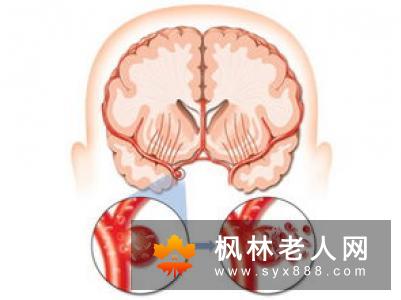 男性小便带血是怎么了 早治疗早轻松