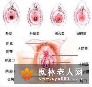 尿道炎别吃这四类食物 赶快为他转发