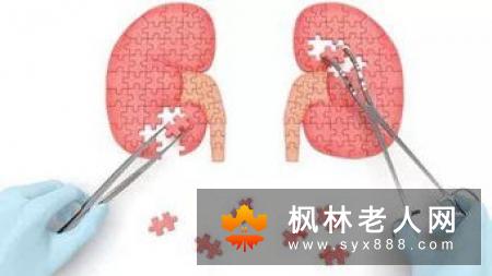 肾脏是人体重要的器官之一影响着身体代谢