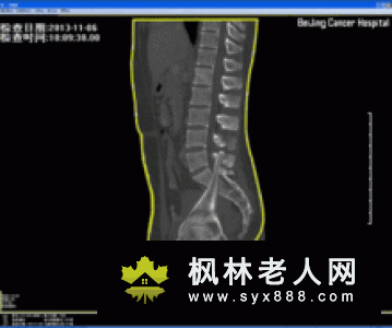 太极锻炼过度也是这类疾病出现的罪魁祸首
