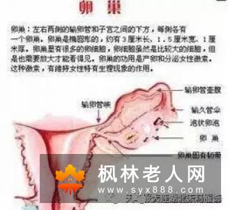 卵巢囊肿对女性的严重危害
