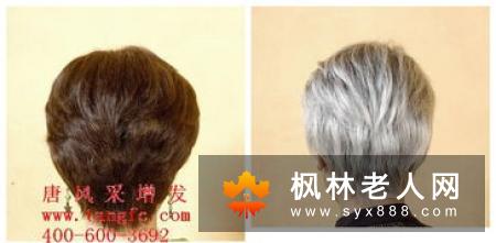 分析少年白的原因 让白发变黑的技巧