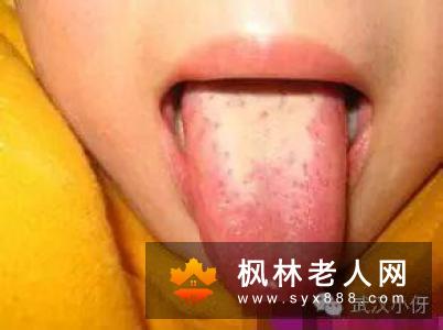 精液发黄能不能要孩子 需要治疗吗