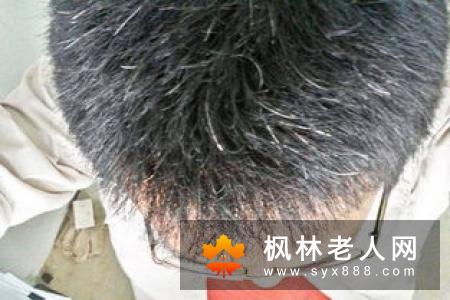 中医看肾透支 中医教你补回肾透支