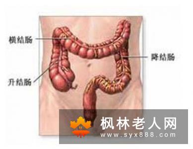 卵巢囊肿患者日常的留意事项有哪些