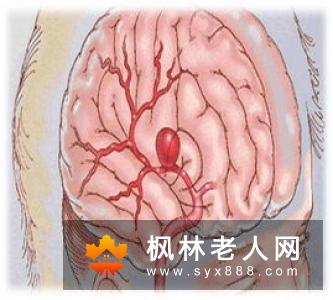揭秘肾结石给男性带来的3大危害