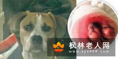 男子长期嚼槟榔 整个食道和喉咙全割掉