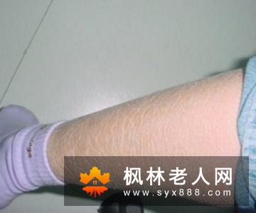 老年人如何锻炼腿?暖双足暖足就是要练屈肌踮脚走路