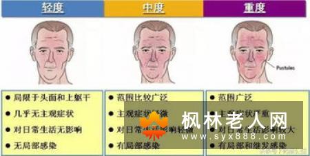 便秘会产生痤疮皮疹？春季便秘该怎么办