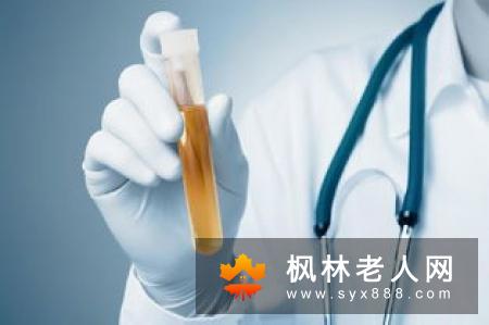 肾脏是人体重要的器官之一影响着身体代谢