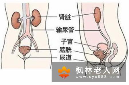 男性霉菌性尿道炎有什么症状 怎么治疗