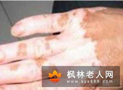 老年人如何锻炼腿?暖双足暖足就是要练屈肌踮脚走路