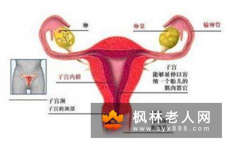 难以治愈的卵巢囊肿危害