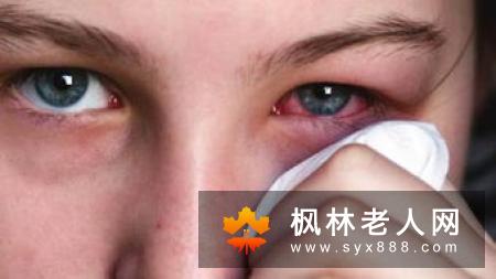 按摩穴位可以祛除眼部浮肿  还你美美的大眼睛