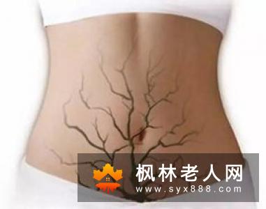 哪些原因会导致女性出现雄性激素过高情况
