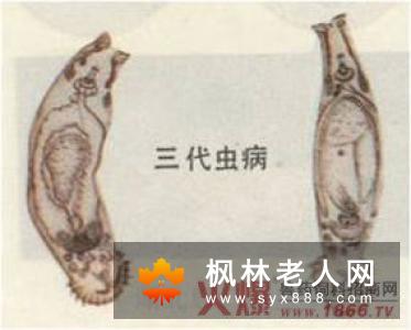 疾病防治需知 老年痴呆有哪些症状