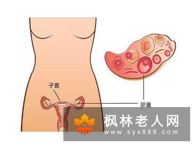 输卵管通液的副作用