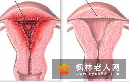 白带是阴道健康的参照物  警惕白带异常预示的疾病