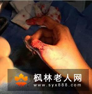 老人锻炼的四项指导原则