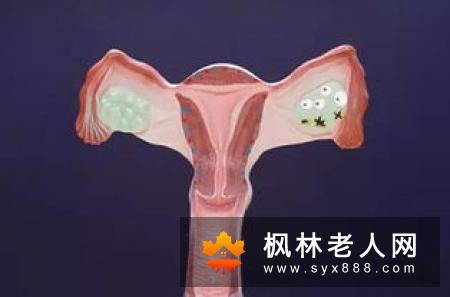 卵巢囊肿的日常护理措施包括哪些
