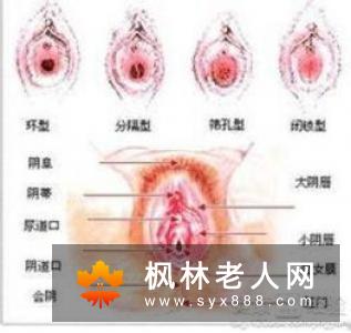 卵巢癌的5大早期症状