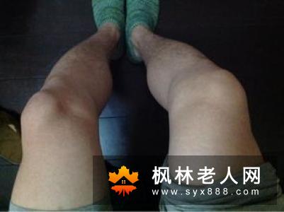 老年人腿脚僵硬应该怎么办?