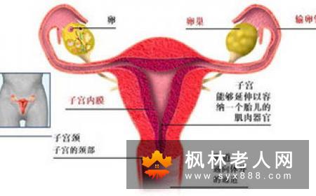 卵巢癌的前期症装