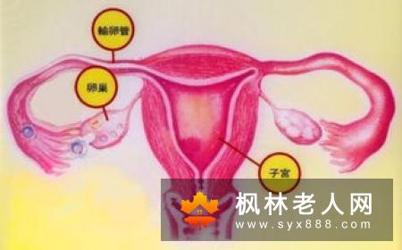 卵巢囊肿带给女性的危害