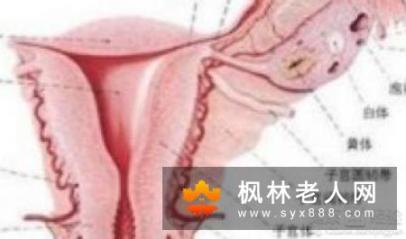 附件炎的症状有哪些表现？