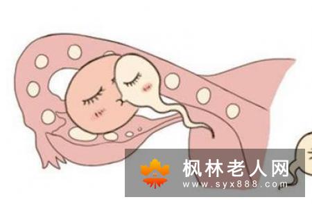 卵巢早衰的真相