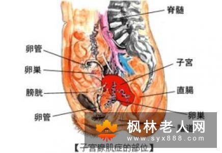 为什么卵巢会早衰呢？卵巢早衰原因