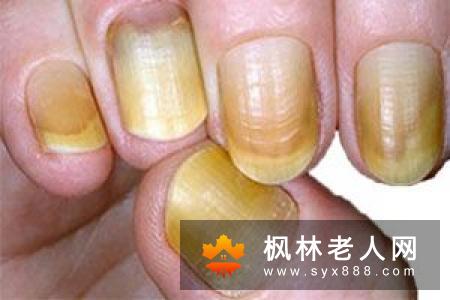 脾气大易引起肝气郁结,按摩身上的7大“撒气穴位”,即能缓解情绪波动