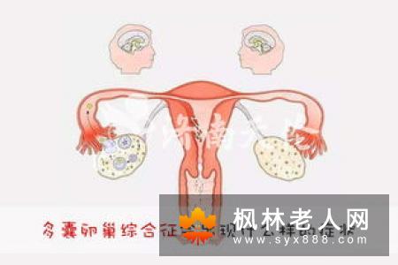 导致多囊卵巢综合症不孕原因