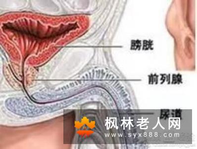 小便刺痛应该做哪些检查?-家居装修问答