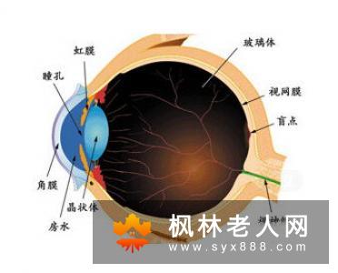 白内障早期症状