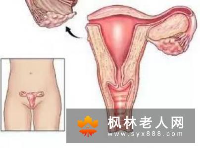 女人早预防卵巢早衰避免提前变老
