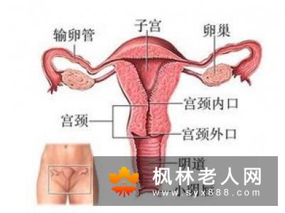 输卵管通畅闭塞的治疗