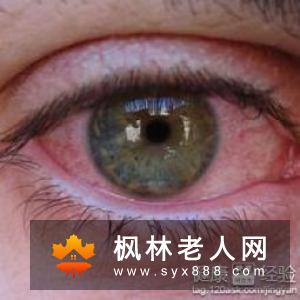 白内障早期症状有哪些？