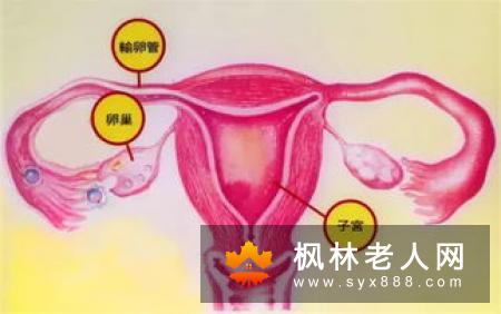 卵巢囊肿会给女性带来哪些危害